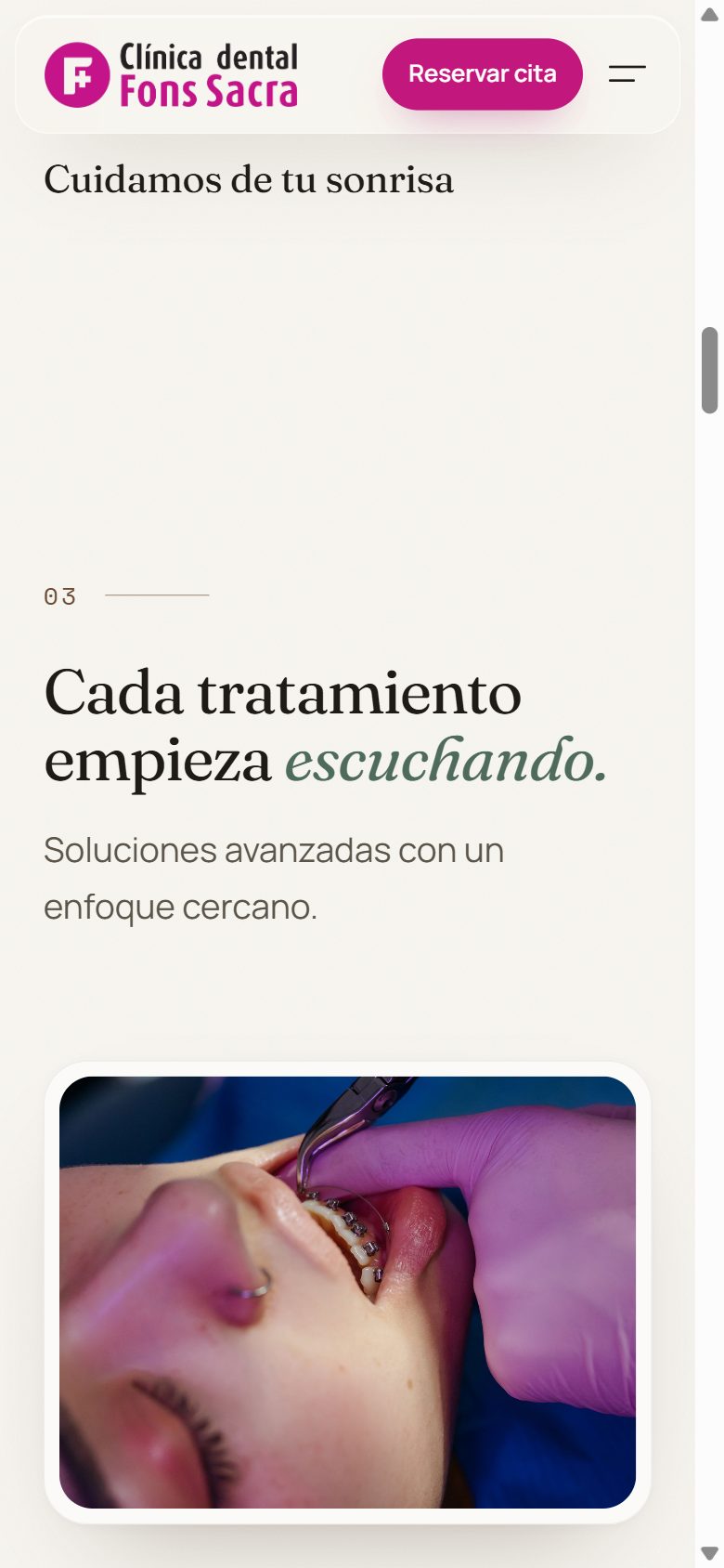 Introducción a los tratamientos en el móvil