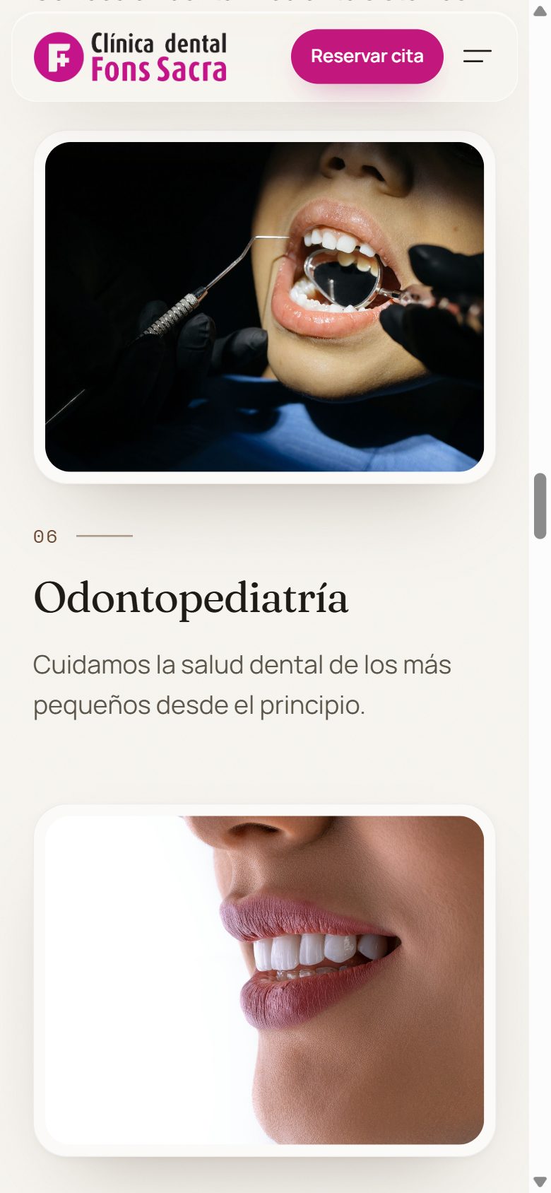 Tratamiento de odontopediatría en el móvil