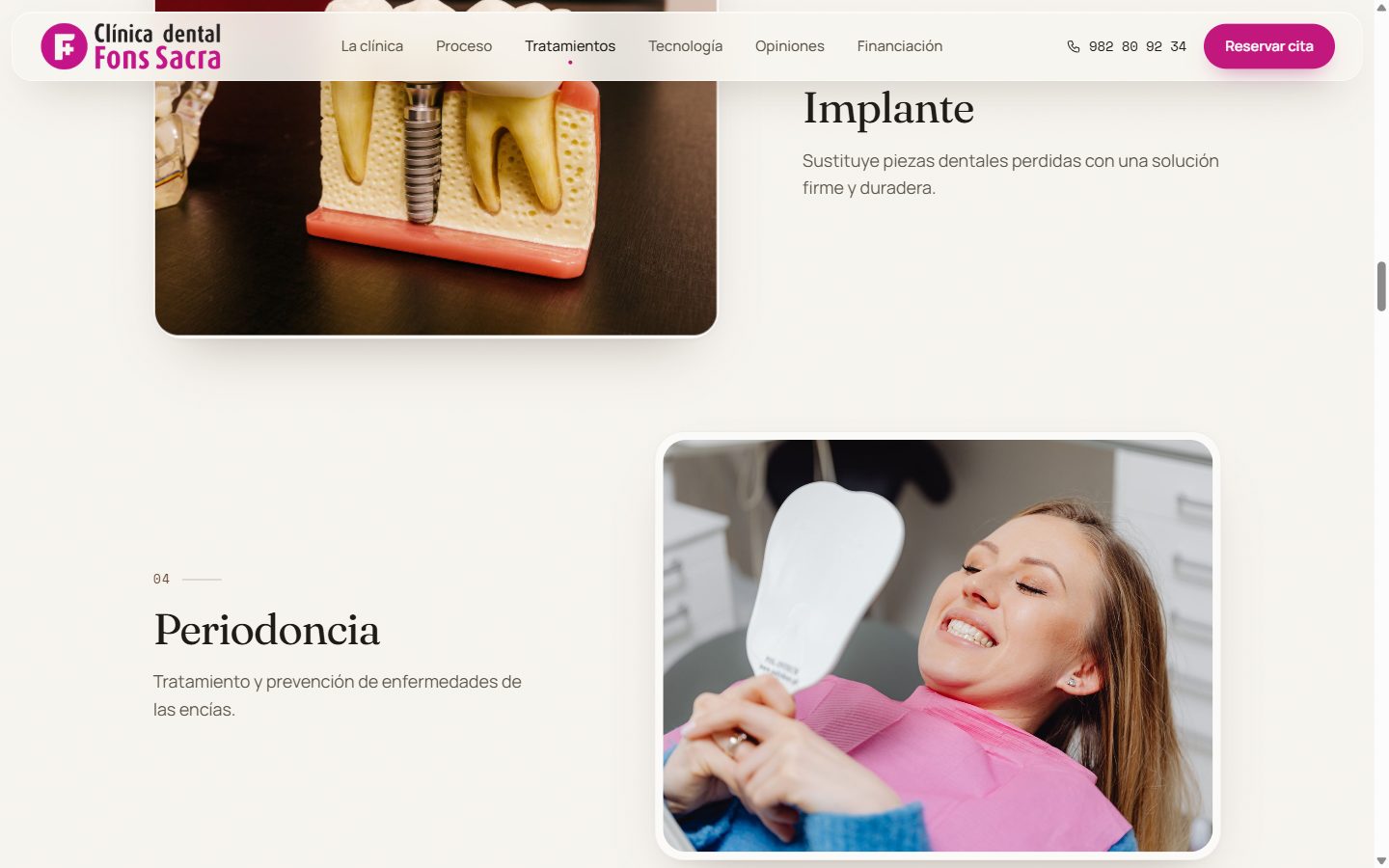 Sección de tratamientos de la web, con fotos de implante y periodoncia